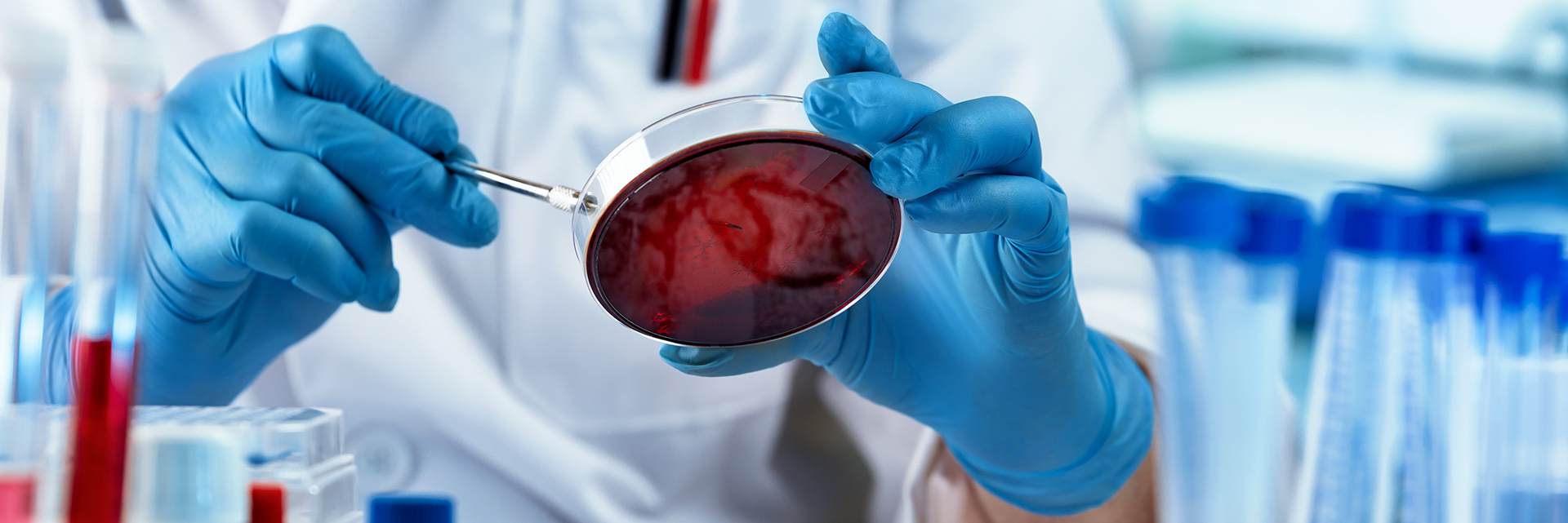 Chemist with blue gloves, holding up petri dish with red colour and materials. Test tubes in the background of laboratory
