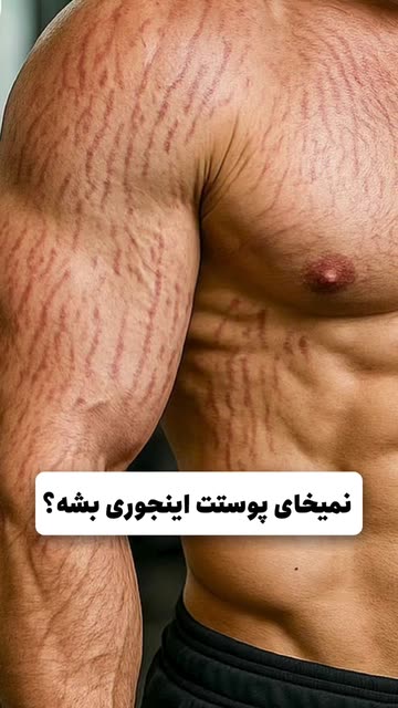 ارایشی بهداشتی و مراقبت پوستی