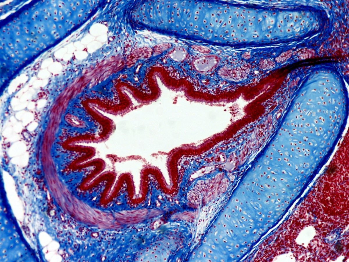 Bronchus segmentalis