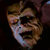 ulcer thumbnail