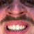 blindanemo thumbnail