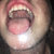 s thumbnail