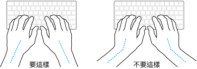 雙手置於鍵盤上,分別顯示正確與不正確的手肘與雙手對稱擺放位置。
