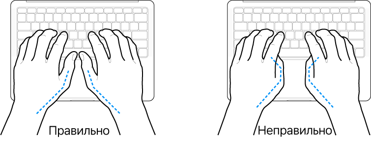Руки над клавиатурой. Показано правильное и неправильное положение большого пальца.
