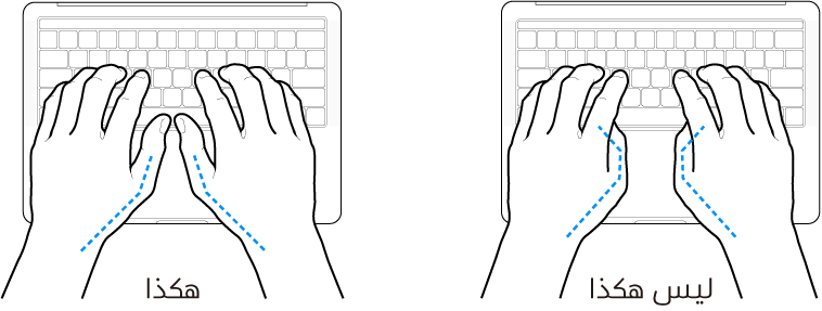 يدان موضوعتان على لوحة مفاتيح، ويظهر الوضع الصحيح وغير الصحيح للإبهامين.