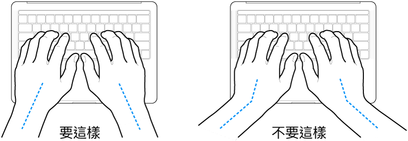 雙手置於鍵盤上,分別顯示正確與不正確的手肘與雙手對稱擺放位置。