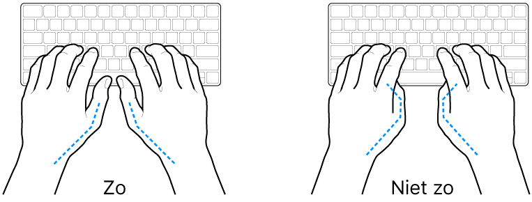 Handen boven een toetsenbord, waarbij de goede en verkeerde stand van de duimen wordt aangegeven.