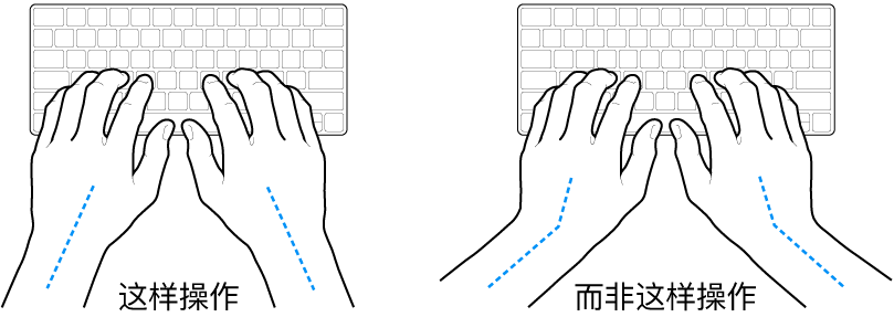 手掌放在键盘上方,显示手腕和手掌的正确对齐位置和错误对齐位置。