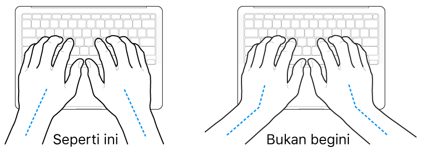 Tangan diposisikan di atas papan ketik, menampilkan penyejajaran pergelangan tangan dan tangan yang benar dan salah.