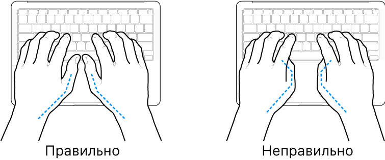 Руки розташовано над клавіатурою й показано правильне та неправильне положення великих пальців.