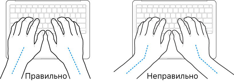 Руки розташовано над клавіатурою й показано правильне та неправильне положення кистей і рук.