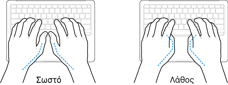 Χέρια τοποθετημένα επάνω σε ένα πληκτρολόγιο, που δείχνουν τη σωστή και τη λανθασμένη θέση των αντίχειρων.