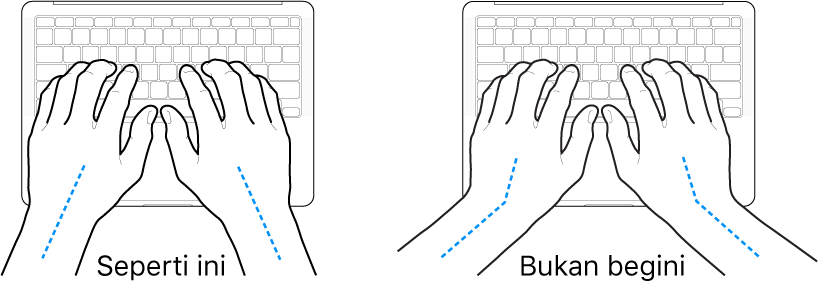 Tangan diposisikan di atas papan ketik, menampilkan penyejajaran pergelangan tangan dan tangan yang benar dan salah.