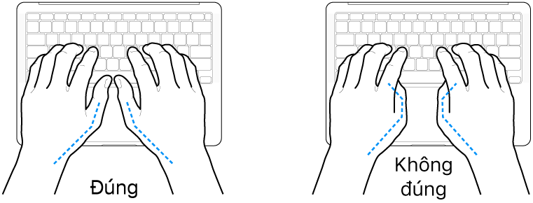 Các bàn tay đặt phía trên bàn phím, minh họa cách đặt ngón cái đúng và sai.