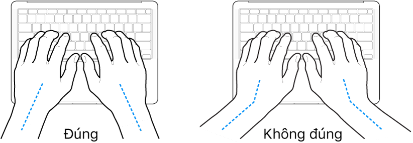 Các bàn tay đặt phía trên bàn phím, minh họa cách đặt cổ tay và bàn tay đúng và sai.