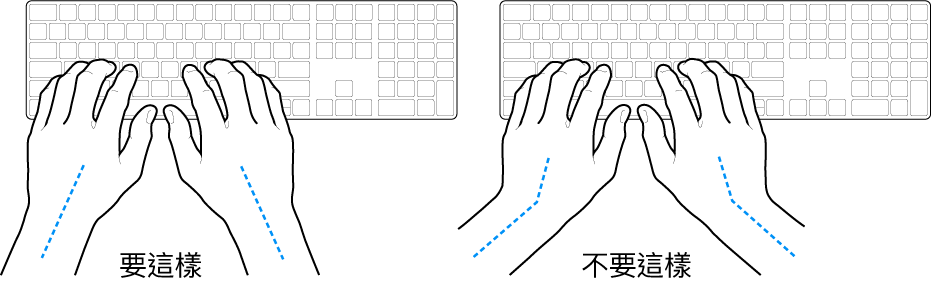 雙手置於鍵盤上,分別顯示正確與不正確的手肘與雙手對稱擺放位置。