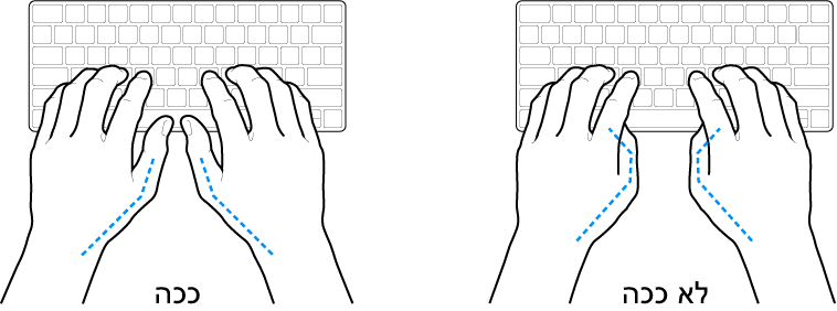 ידיים מעל מקלדת, להדגמת מנח נכון ומנח שגוי של האגודלים.
