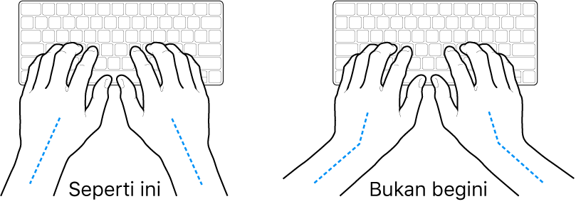 Tangan diposisikan di atas papan ketik, menampilkan penyejajaran pergelangan tangan dan tangan yang benar dan salah.