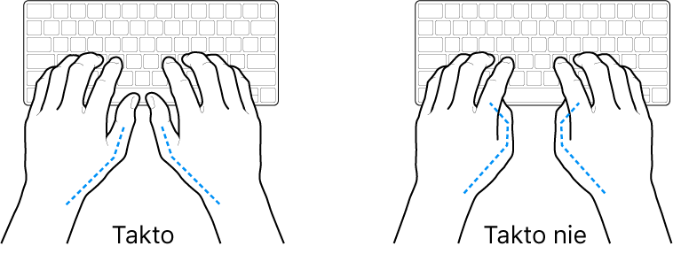 Ruky položené na klávesnici znázorňujúce správnu a nesprávnu polohu palcov.