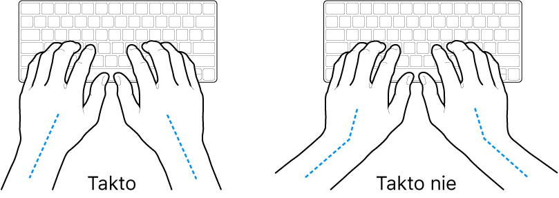 Ruky položené na klávesnici znázorňujúce správnu a nesprávnu polohu zápästia a ruky.