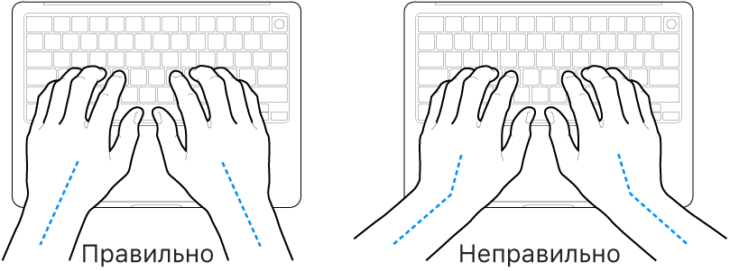 Руки розташовано над клавіатурою й показано правильне та неправильне положення кистей і рук.
