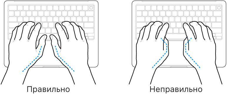Руки розташовано над клавіатурою й показано правильне та неправильне положення великих пальців.