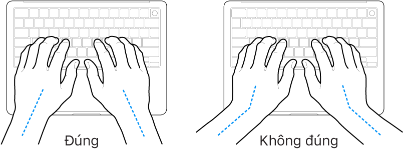 Các bàn tay đặt phía trên bàn phím, minh họa cách đặt cổ tay và bàn tay đúng và sai.
