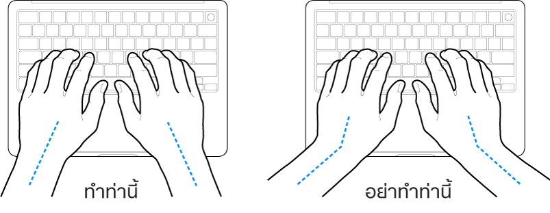 มือวางอยู่เหรือแป้นพิมพ์ แสดงตำแหน่งการวางข้อมือและแขนที่ถูกต้องและไม่ถูกต้อง