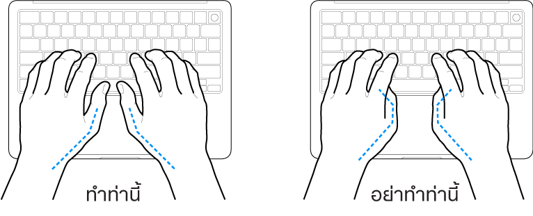 มือวางอยู่เหรือแป้นพิมพ์ แสดงตำแหน่งการวางนิ้วหัวแม่มือที่ถูกต้องและไม่ถูกต้อง