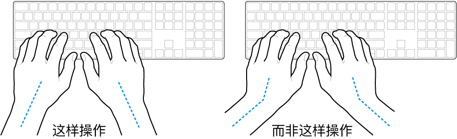 手掌放在键盘上方,显示手腕和手掌的正确对齐位置和错误对齐位置。