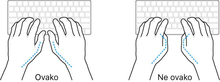 Ruke položene na tipkovnicu s prikazom pravilnog i nepravilnog položaja palaca.