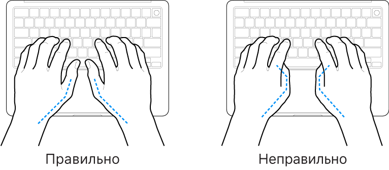 Руки розташовано над клавіатурою й показано правильне та неправильне положення великих пальців.