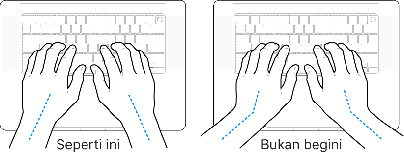 Tangan diposisikan di atas papan ketik, menampilkan penyejajaran pergelangan tangan dan tangan yang benar dan salah.