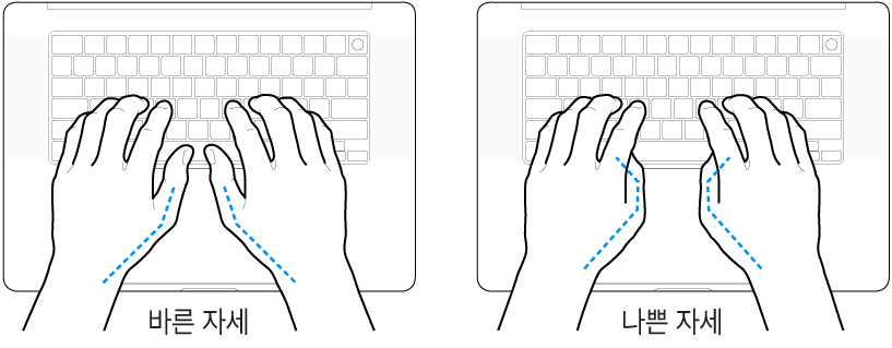 엄지손가락의 바른 위치와 잘못된 위치를 보여주는 키보드 위의 손.