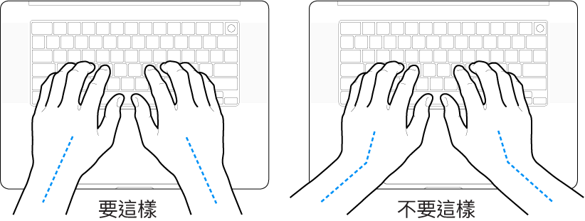 雙手置於鍵盤上,分別顯示正確與不正確的手肘與雙手對稱擺放位置。