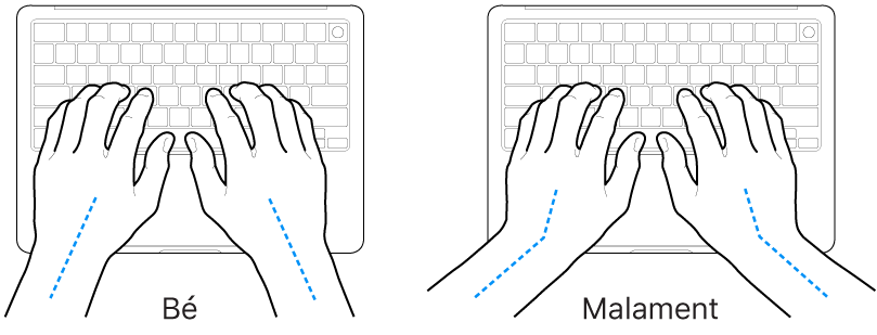 Unes mans posades sobre un teclat mostrant l’alineació correcta i incorrecta del canell i la mà.