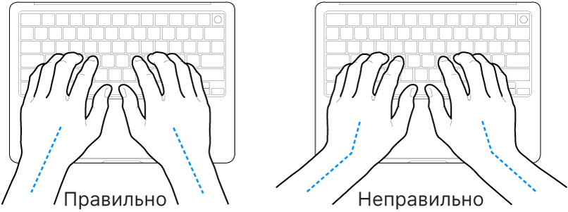 Руки розташовано над клавіатурою й показано правильне та неправильне положення кистей і рук.
