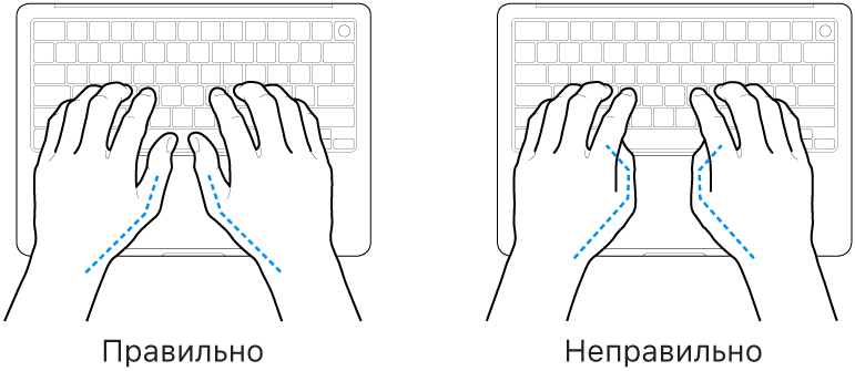 Руки розташовано над клавіатурою й показано правильне та неправильне положення великих пальців.