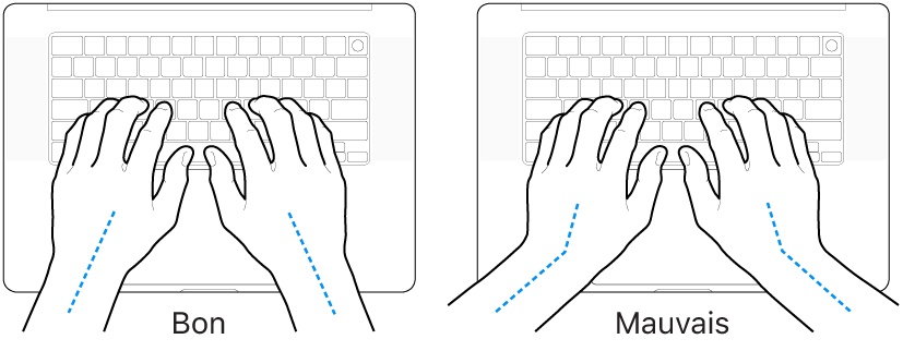 Mains placées sur un clavier, montrant le bon et le mauvais alignement des poignets et des mains.