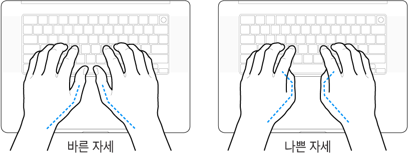 엄지손가락의 바른 위치와 잘못된 위치를 보여주는 키보드 위의 손.