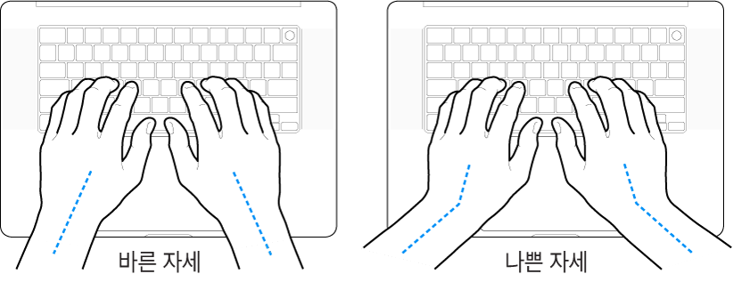 손목 및 손의 바른 자세와 잘못된 자세를 보여주는 키보드 위의 손.