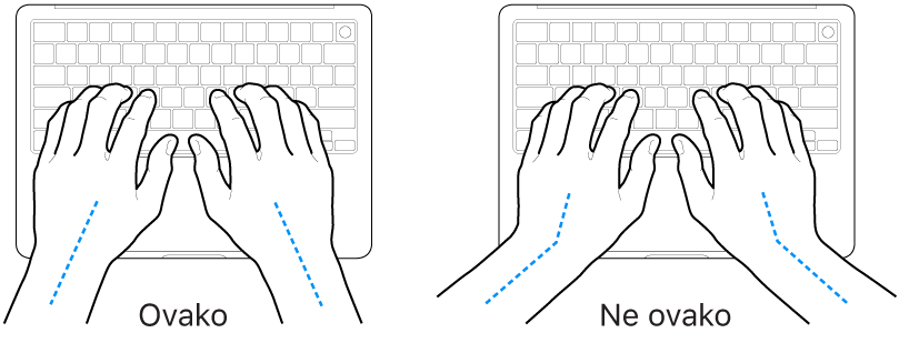 Ruke položene na tipkovnicu s prikazom pravilnog i nepravilnog položaja zapešća i ruku.
