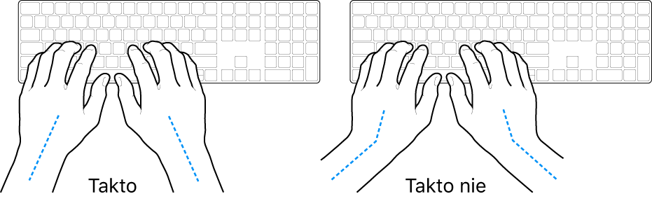 Ruky položené na klávesnici znázorňujúce správnu a nesprávnu polohu zápästia a ruky.