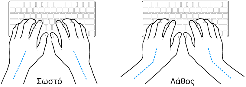 Χέρια τοποθετημένα επάνω σε ένα πληκτρολόγιο, που δείχνουν τη σωστή και τη λανθασμένη θέση των καρπών σε σχέση με τα χέρια.