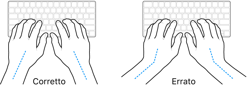 Mani posizionate su una tastiera che illustrano l’allineamento corretto ed errato di polso e mano.