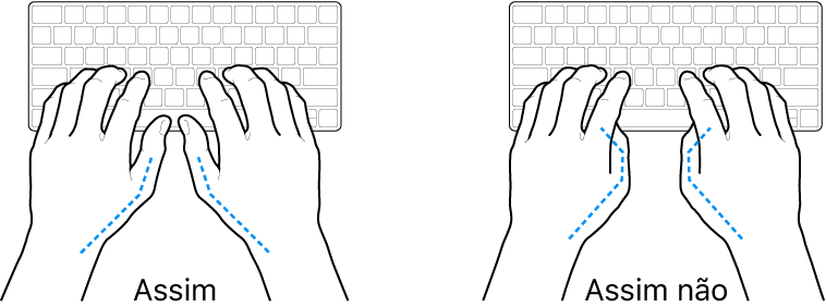 As mãos posicionadas sobre um teclado a mostrar a colocação correta e incorreta dos polegares.