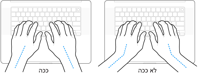 ידיים מעל מקלדת, להדגמת מנח נכון ומנח שגוי של כף היד ושורש כף היד.