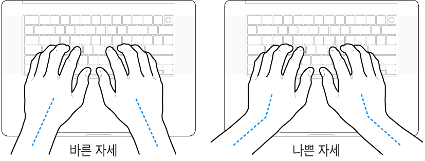 손목 및 손의 바른 자세와 잘못된 자세를 보여주는 키보드 위의 손.