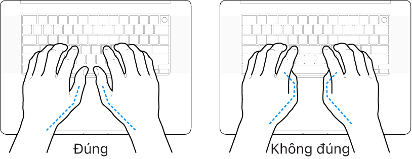 Các bàn tay đặt phía trên bàn phím, minh họa cách đặt ngón cái đúng và sai.