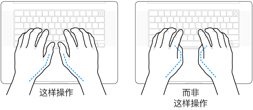手掌放在键盘上方,显示拇指的正确放置和错误放置。